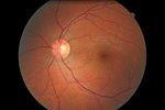 photos of my retinas from a recent visit to the eye doc